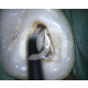 TIPS START-X - TIPS N°1 COMPATIBLE SATELEC