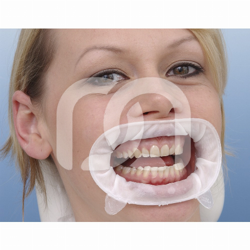 Ecarteur optragate 3d, Fourniture dentaire, Equipement dentiste