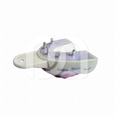 MIRATRAY IMPLANT - KIT INTRODUCTION 