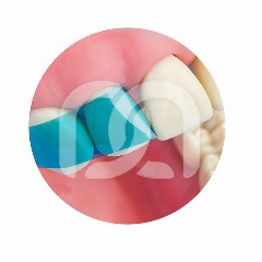 VARISTRIP BLUE VIEW - ANTERIOR MATRICES (100)