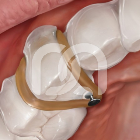 THE TEAR DROP HU-FRIEDY TANG