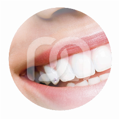 SKYCE KRISTALLEN (5)