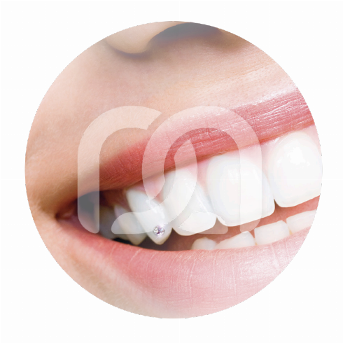 SKYCE CRISTAL TOOTH GEMS 2.4 MM (5)