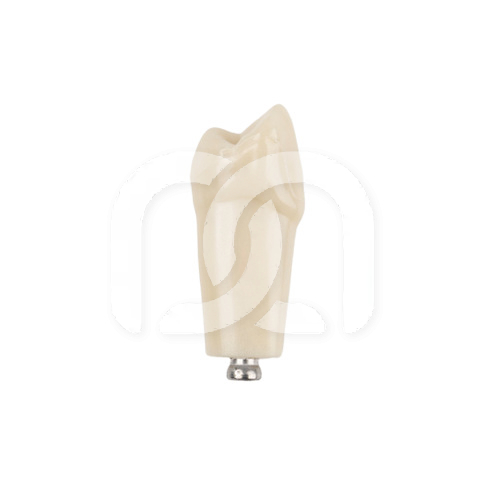 TAND VOOR MODEL FRASACO ANKA-4