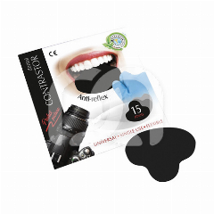 Zwarte Contrastplaat Voor Dentale Fotografie (15 Stuks)