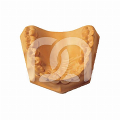 Plâtre Dentaire Silky-Rock Classe IV (15kg)