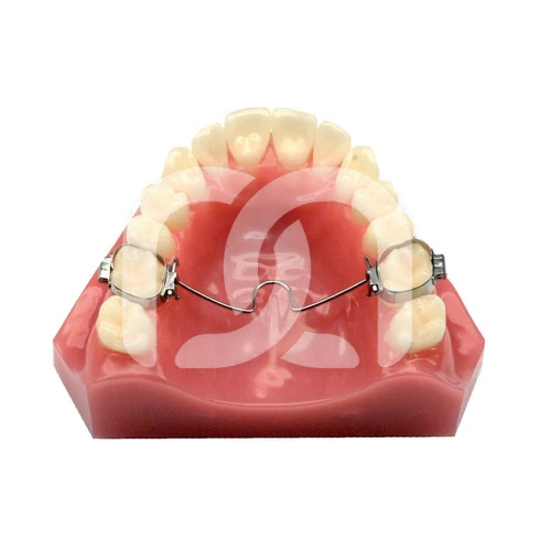 Arc Transpalatin Mésial pour Molaires (1)