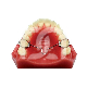 Arc Transpalatin Mésial pour Molaires (1) : LARGEUR:55 MM, POSITIONNEMENT:DISTAL