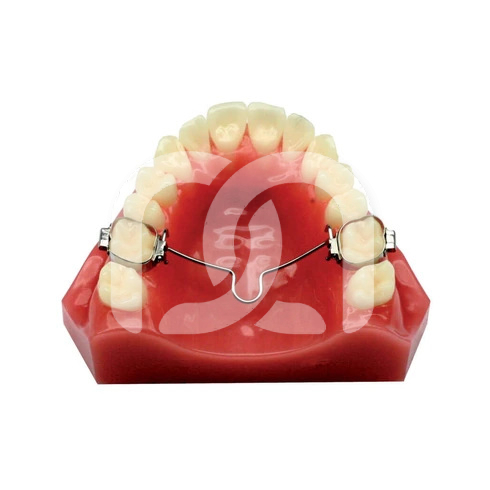 Arc Transpalatin Mésial pour Molaires (1)