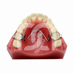 Dispositif d'Expansion Quad-Helix Maxillaire (1)