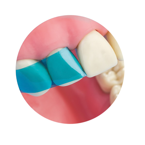 VARISTRIP BLUE VIEW - ANTERIOR MATRICES